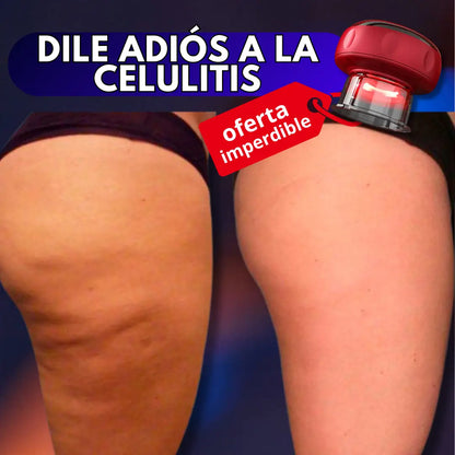 RELAXCUP®️ - ADIÓS A LA CELULITIS 🎀 ¡Lleva el segundo casi regalado! 🎁
